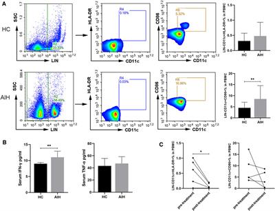 Long Noncoding RNA and Circular RNA Expression Profiles of Monocyte-Derived Dendritic Cells in Autoimmune Hepatitis